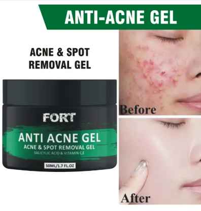 Fort Anti Acne Gel For Acne